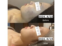 クレシア(CRECIA)/REVI取扱店