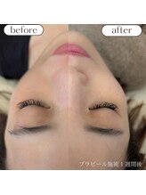 ケアプラス/プラピール