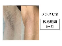 メンズビオ 神戸三宮店/