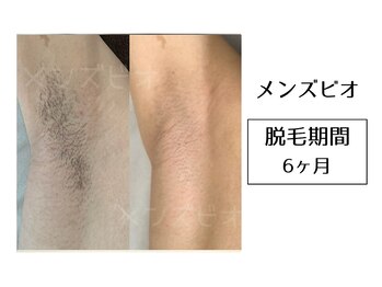 メンズビオ 神戸三宮店/