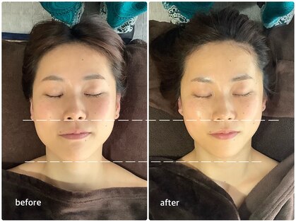 アベリア リュウ(Aberia Lieu)の写真