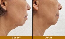 ルドゥーテ 塩釜