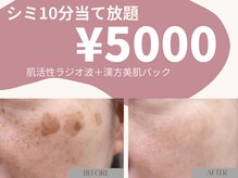 ウィズマツオカ 光の森店の雰囲気(シミケア10分当て放題で話題の効果!みるみるうちに剥がれます☆)
