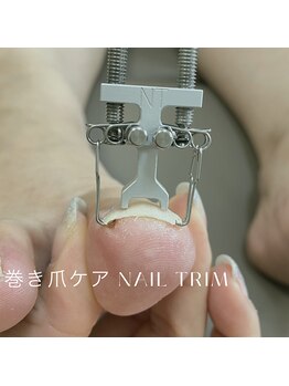ロンディネ(Rondine)の写真/親指の巻き爪食い込みトラブル予防!爪周りの角質・ゴミ・匂いもケア♪