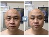【清潔感爆上げ】男のフェイスリフトケア