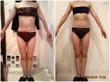 パーフェクトボディプレミアム 名古屋駅前店(PERFECT BODY PREMIUM)/お客様　ビフォーアフター（26）