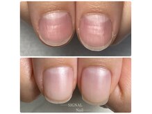 シグナルネイル(SIGNAL Nail)の雰囲気（爪本来の美しさを取り戻し【健康な美爪】へ）