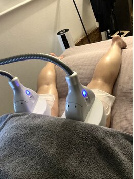 サロン ヴィヴァン(salon vivante)の写真/【結果重視の方必見!!】宮崎希少の機械で気になる脂肪を冷却分解☆スッキリとした憧れのボディラインに♪