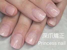 深爪矯正ベーシックピンクラメ