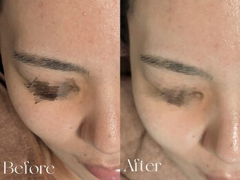 ウィハナ(wehana)/【ララピール】艶/透明感/毛穴