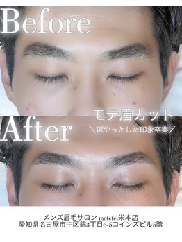 モテテ(motete)/お客様施術例☆栄本店