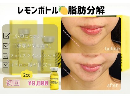 セレーノ 白金台(seReno)の写真