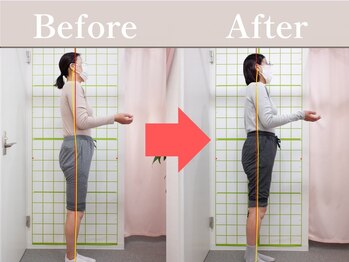 やわた姿勢整体院/50歳女性