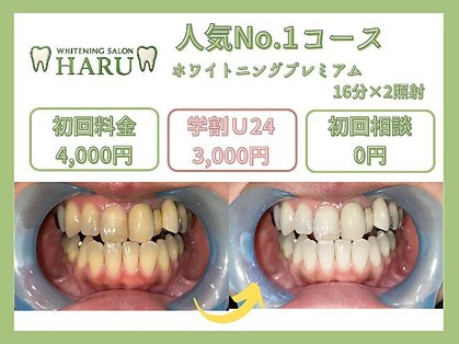 歯のホワイトニングサロン HARU越谷レイクタウンの写真