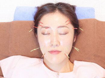 リカバリー整体院 太宰府院の写真/《全スタッフ国家資格保有◎美容鍼で叶える大人の美しさ！¥3,980～》明るくスッキリしたお肌へ◎