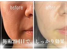 クク 赤坂 天神(99 KUKU)