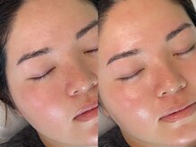 アイブロウエッセンス(eyebrow Essence)の雰囲気（フェイシャルワックスですっぴんでも自信の持てる艶肌に◎）