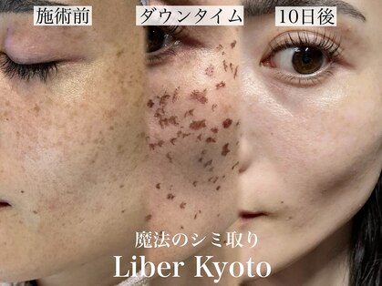 エステティック リベル キョウト 京都駅前店(Esthetic Liber Kyoto)の写真
