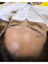 メッテ(mette)/