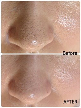 ラヴィアンローズ 蒲郡店(& La vie en Rose)/毛穴ケア