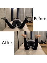 おこしんちゅ 渋谷 代々木公園/股関節の歪み改善！初回の様子