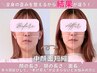 【中顔面短縮矯正】エラ/たるみ/コリ★頭蓋骨小顔＆全身×痩身マシン初回体験
