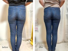 ヨサパーク 新百合ヶ丘店(YOSA PARK)/【before&after】