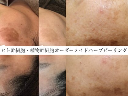 ライリー(Rairy)の写真