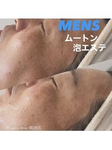 キレイシェア バイ プリンセスローズ静岡駅店(KIREI SHARE)/ムートン泡エステ