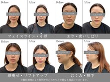 イクイノックス 錦糸町(EQUINOX)