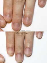 マリーロール 梅田店(Marie Laure)/自爪育成/深爪矯正/ネイルケア