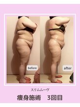 アコルデビューティー 恵比寿店(Acorde Beauty)/ビフォーアフター