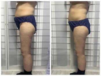 グランドール(Grandeur)/痩身