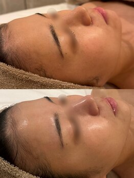 セレニテ(Serenite)/