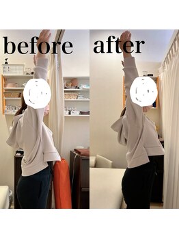 えにし整体 鍼灸整骨院/えにし式筋膜リリース整体