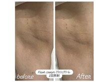エナッシュビューティサロン(ENASH)/フラッシュクリーム使用