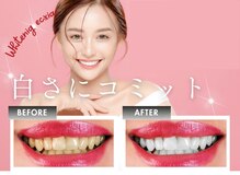 エクシアホワイト 長野店