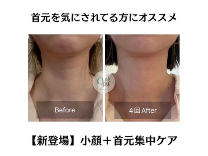 キュープ 北千住店(Qpu)の写真