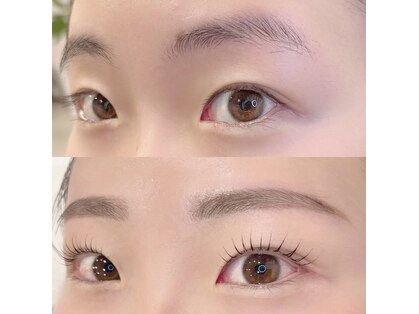 ホワイトアイ 大分(WHITE EYE)の写真
