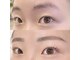 ホワイトアイ 大分(WHITE EYE)の写真