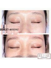 エリス(ELISSE)/ハリウッドブロウリフト