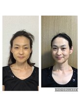 マカニ 河原町御池(makani)/小顔矯正ビフォーアフター