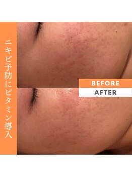 カオヤ プラス(Kaoya plus)/エンビロン無料カウンセリング◎