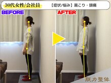 幸せのもり整体院/【30代女性／会社員】Uさん