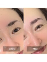 ハッピーアリスター(HAPPY ALISTER)/ハリウッドブロウリフト/HBL