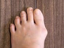 フジ 整体院(FUJI)/足の指の痛み改善プラン