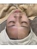 【maki限定】facial mix 脱毛＋毛穴洗浄