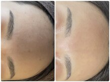 ラヴィ(Ravi)/ハリがあるお肌