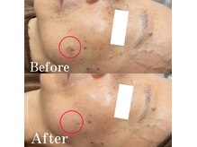 フォルチェ ゆめタウン広島店(Folche)