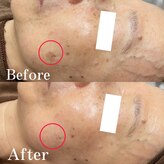 フォルチェ ゆめタウン広島店(Folche)